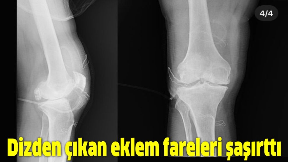 Dizden çıkan eklem fareleri şaşırttı